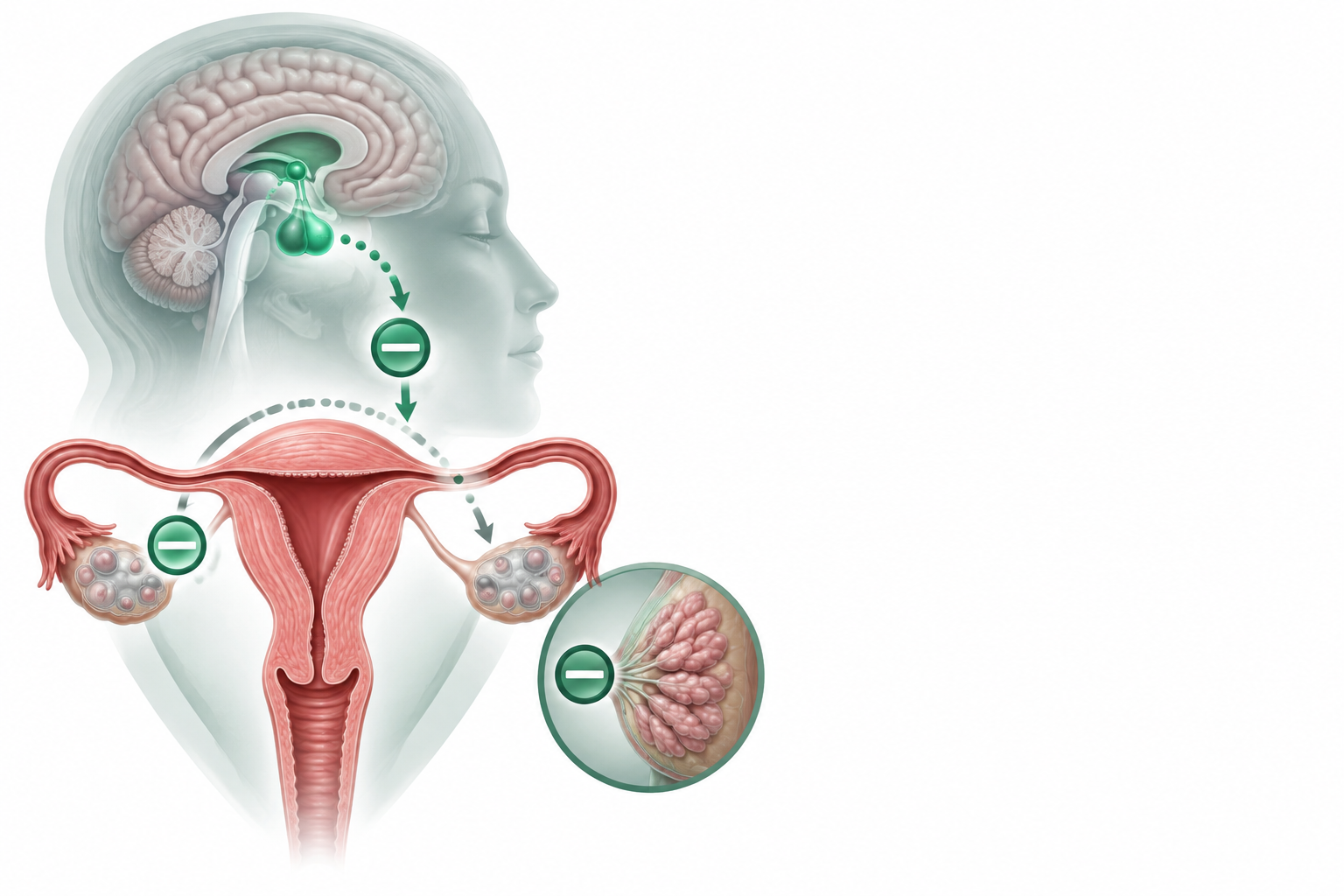 أيثنيل أستراديول و دروسبيرينون | Ethinyl Estradiol and Drospirenone — رسم توضيحي لفئة متلازمة انقطاع الحيض واللبن