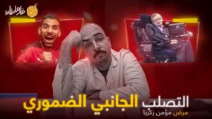 التصلب الجانبي الضموري