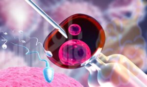 Acquired immunodeficiency syndrome (AIDS) | متلازمة النقص المناعي المكتسب (الإيدز)
