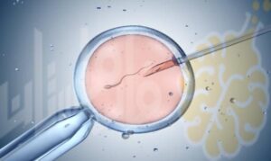 Premature ejaculation | سرعة القذف
