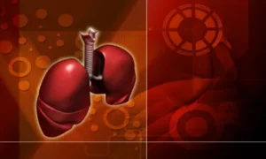 مضادات الالتهاب ومضاعفات الالتهاب الرئوي