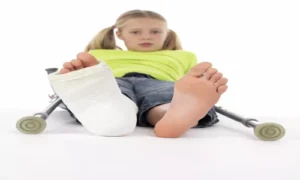 جبس ساق واحدة لعلاج كسور الأطفال