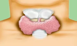 زيادة سرطان الغدة الدرقية: خطر الأشعة