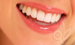 أفضل طرق للحفاظ على ابتسامة صحية