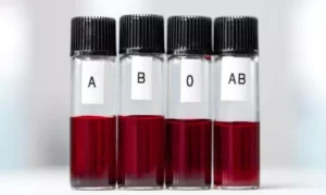 فصيلة دمك وخطر السكتة الدماغية