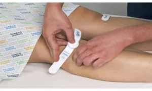 جهاز جيكو: أمل جديد لمنع الجلطات