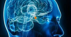 التهاب النخامية | Hypophysitis