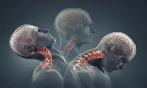 الأيروبيك: علاج واعد لارتجاج المخ