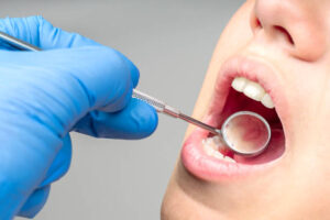 حساسية الاسنان | Teeth Sensitivity