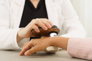 الجلد الحرشفي | Scale