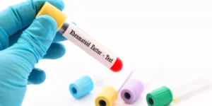 العامل الروماتويدي | Rheumatoid Factor Test