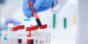 فيتامين أ | Vitamin A Test