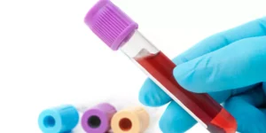 تحليل تكدس الصفائح الدموية | Platelet Aggregation Test
