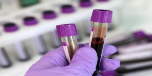 اختبار الثايرو جلوبيولين | Thyroglobulin Test