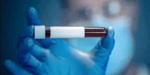 تحليل مستضد فيروس الكبد الوبائي ب | Hepatitis B e Antigen and Antibody Test