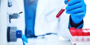 تحليل الأجسام المناعية المضادة للسيتوبلازم | Antineutrophil Cytoplasmic Antibodies Test