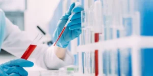 الجلوبولين المناعي (م) لجرثومة توكسوبلازما | Toxoplasma Gondii IgM Test