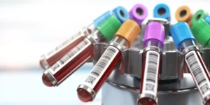 فيتامين ك | Vitamin K Test
