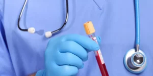 اختبار البروتين المتفاعل عالي الحساسية | High Sensitivity C Reactive Protein Test