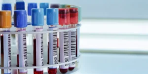 مغنيسيوم الدم | Magnesium Blood Test