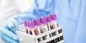 درجة حموضة الدم | Blood pH Test