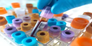 تحليل قياس توزيع الصفائح الدموية | Platelet Distribution Width