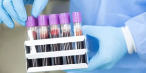 الكالسيوم المتأين | Ionized Calcium Test