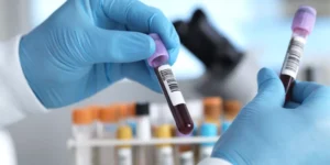 تحليل الغلوبين المناعي م | Immunoglobulin M Test