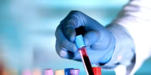 معدل ترسيب كريات الدم الحمراء | Erythrocyte Sedimentation Rate Test