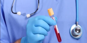 فحص الدهنيات في الدم | Lipid Profile