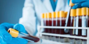 فيروس نقص المناعة البشرية | Human Immunodeficiency Virus Test