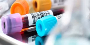 تحليل الكالسيوم المصحح | Corrected Calcium Test