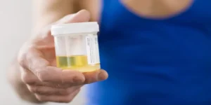 تحليل الكرياتينين في البول بشكل عشوائي | Random Urine Creatinine Test