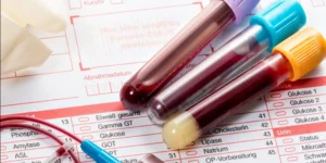 تحليل الأجسام المضادة للترانسغلوتاميناز | Anti-Tissue Transglutaminase Antibody Test