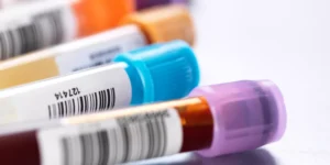 فيتامين هـ (توكوفيرول) | Vitamin E Test