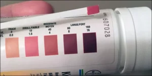 الكيتونات في الدم | Ketones in Blood