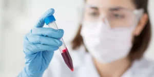 تحليل مضاد الثرومبين | Antithrombin Test