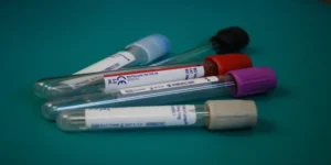تحليل اللاكتات | Lactate Test