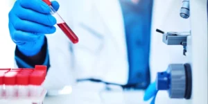 فحص الغلوبيولين الرابط للثيروكسين | Thyroxine-Binding Globulin